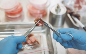 Intestinal tissue samples prepared for CFTR-related ion transport measurement